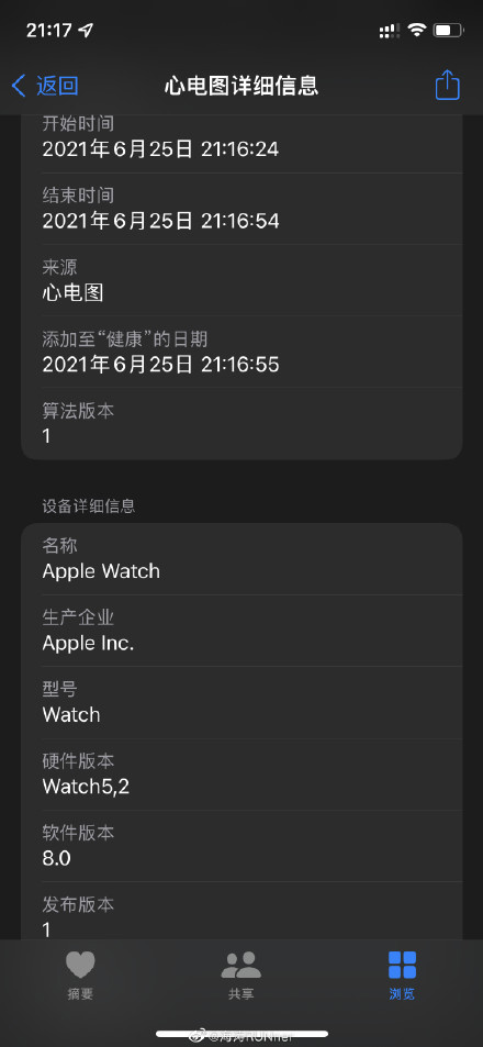 ƻ Apple Watch лҩƷලҽеECG ƶĵͼʾ