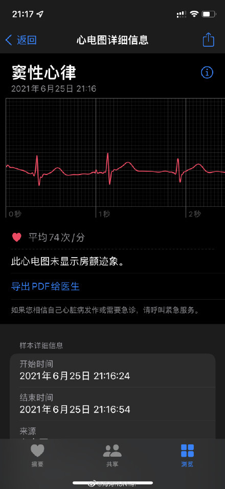 ƻ Apple Watch лҩƷලҽеECG ƶĵͼʾ