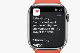 watchOS9½ܡAFibʷڼô׼