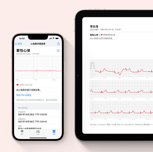 ƻ Apple Watch ĵͼ ECG ܣϸʹ÷