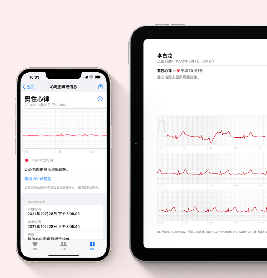 ƻ watchOS 8.3а Apple Watch ʽĵͼ ECG 