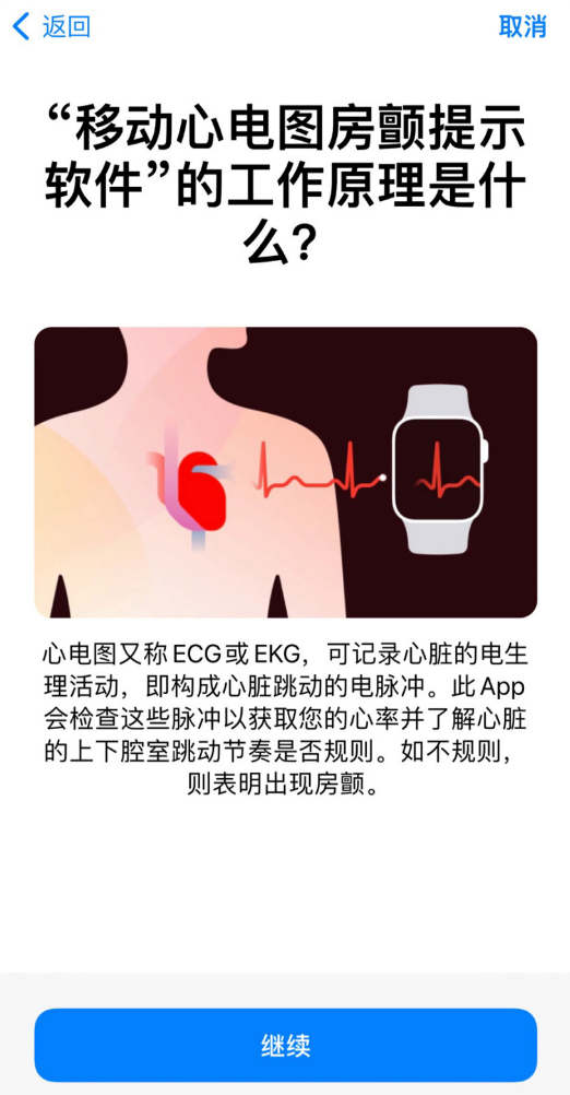  Apple Watch ֱĵͼˣiOS 15.2/WatchOS 8.3 RC Ԥ֧