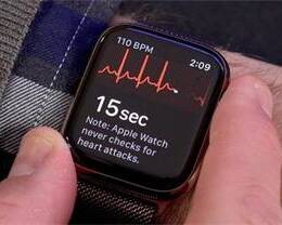  Apple Watch οͨ ECG ܣ