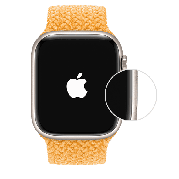 Apple Watch ϵĲ߰ť