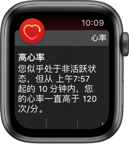 ʹ Apple Watch 쳣