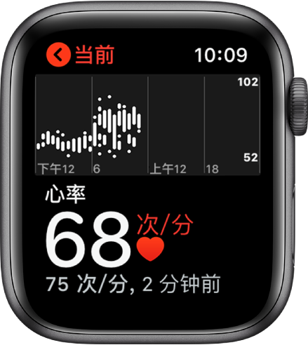 ʹ Apple Watch 쳣